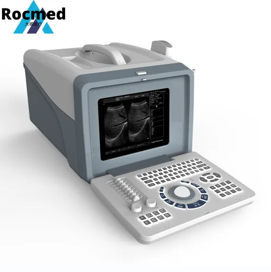 Factory Price Hospital Medical Sonoscape Portable Laptop 2D 3D 4D Color Doppler Ultrasound Scanner Machine for Veterinary and Human