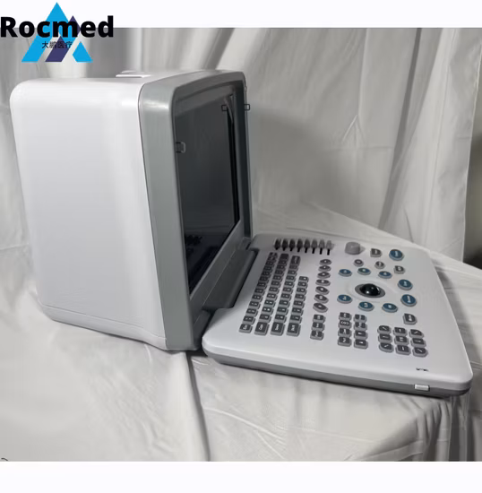 Factory Price Hospital Medical Sonoscape Portable Laptop 2D 3D 4D Color Doppler Ultrasound Scanner Machine for Veterinary and Human